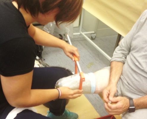 Transtibiale Prothetik - Maßtechnik